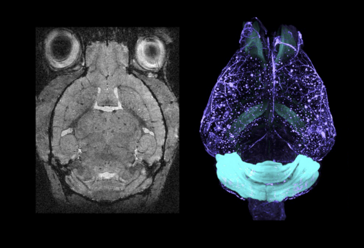 Brain images captured by 15.2 Tesla MRI (left) and light sheet microscopy (right)