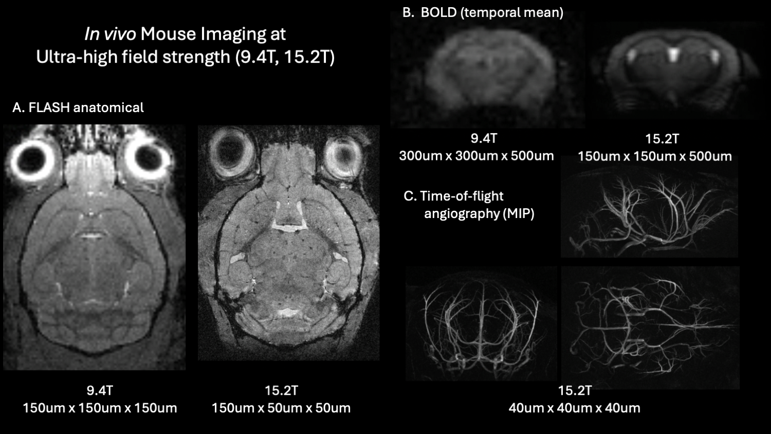 Comparison between 9.4T and 15.2T MRI brain images